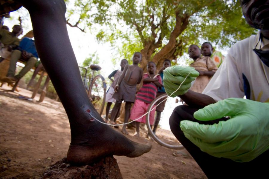 A doctor in Northern Ghana extracts a guinea worm from a child’s leg. Although the parasite is difficult to treat, prevention is as easy
as filtering water before drinking it. Organizations like the Carter Center are working to make the worm extinct over the next several years. (NPR photo)